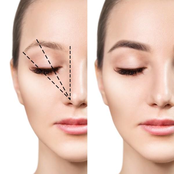 Correction asymétrie visage